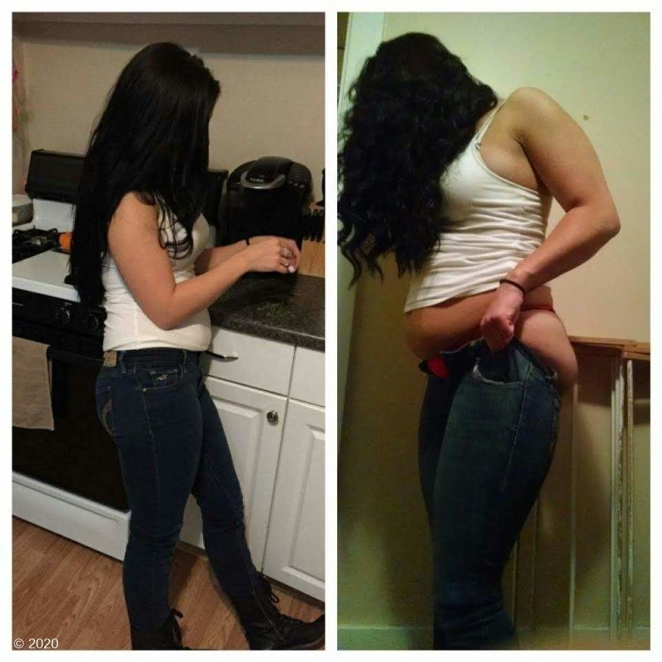 Weight Gain Before And After 3 #98435344