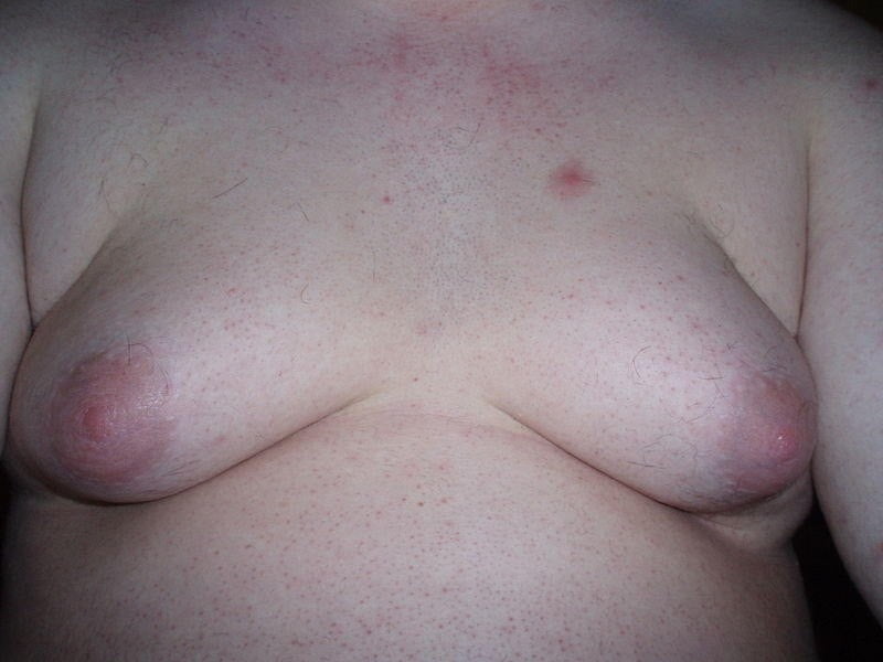 comejaiba more ugly tits #89764462
