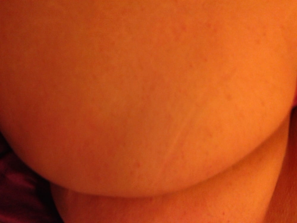 Hot #104523057